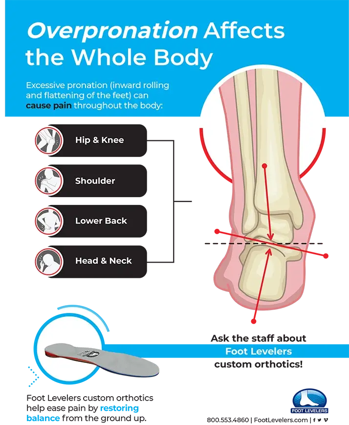 Chiropractic Waukee IA Ankle Flyer Overpronation affects the whole body flyer.