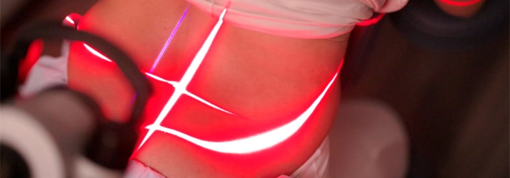 Chiropractic Waukee IA Erchonia Laser Therapy Laser therapy on a persons lower back.
